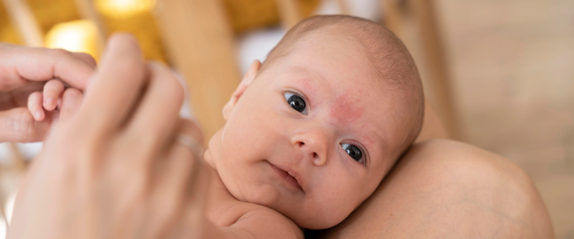 Pelle secca nei neonati: i rimedi per curarla